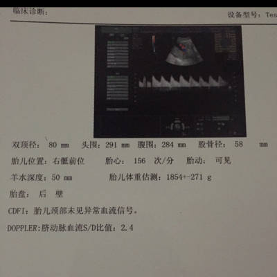 怀孕七个半月 双顶径80mm头围291mm股骨径58mm正常吗,好担心请看图片