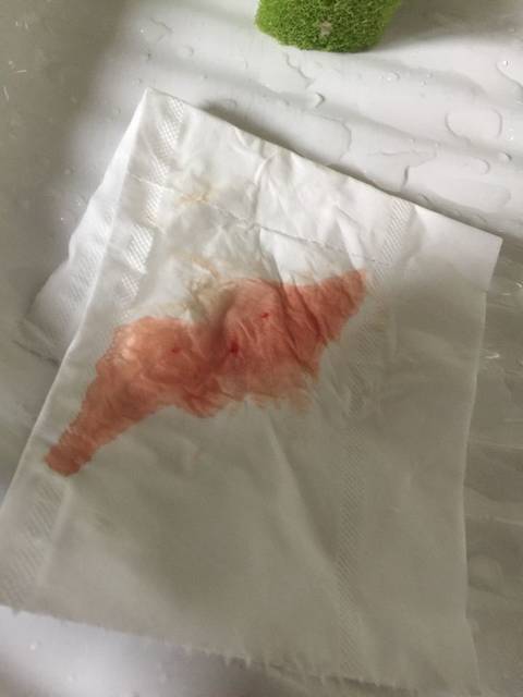 35周加4,早上起来擦拭有血,肚子不疼_怎么办害