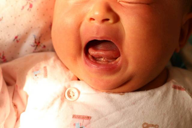 舌头下面一个白色疙瘩_宝宝现在一个月十五天
