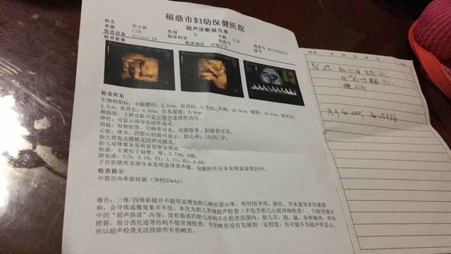 三维彩超检查_22周+4今天做了三维彩超检查一