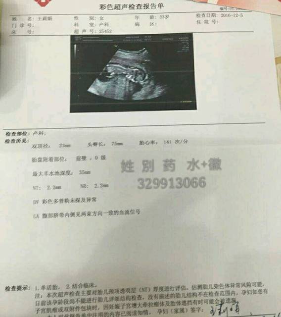 nt顺利通过,三个月b超男孩!