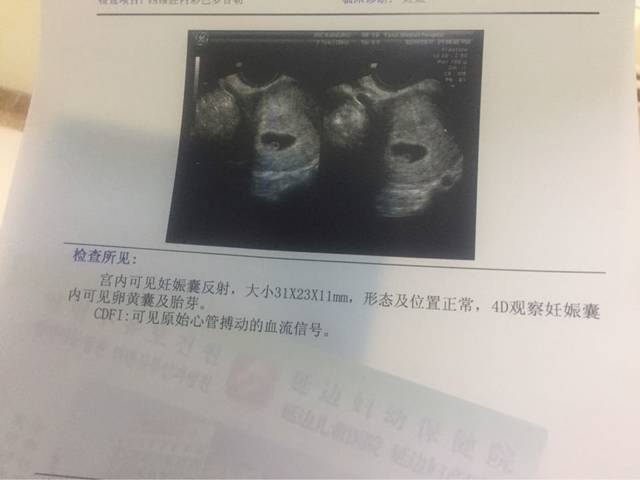 宝妈们帮看下下体男孩_彩超单子看得出来女孩女生突然图片