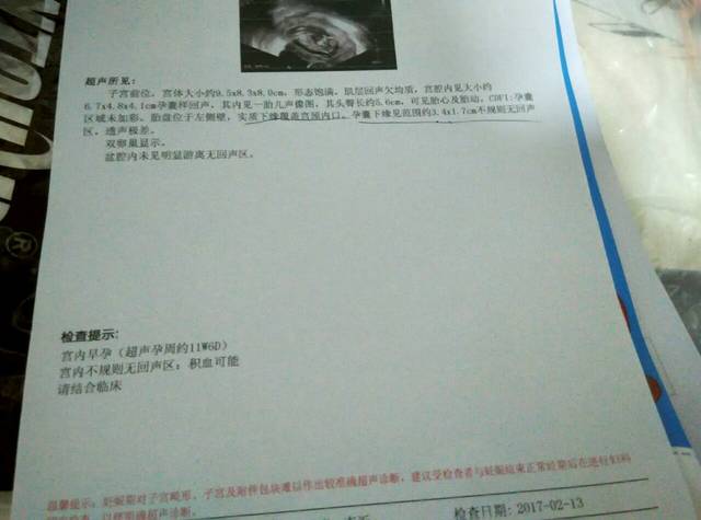 三个月内做了三次彩超，下周一建档又要做彩超，对胎儿有影响吗?__宝宝树