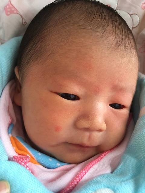 各位宝妈帮忙看看_宝宝脸上长小红点是怎么了