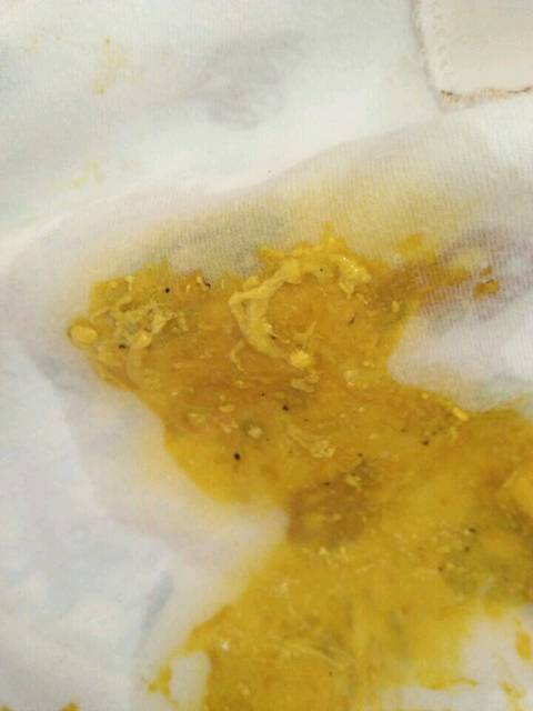 宝宝拉肚子能打疫苗吗