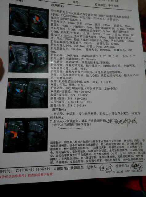 四维照片,一胎男宝,二胎希望是女宝,各位看看是