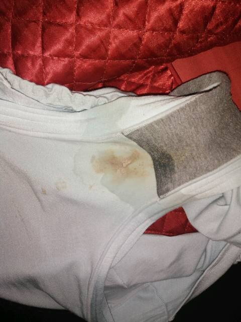 怀孕五个月内裤总是湿 内裤湿多少算是漏羊水