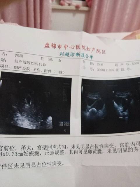 么通过彩超看男女啊?_这个是女生女孩男孩啊还是一字马对好处的图片