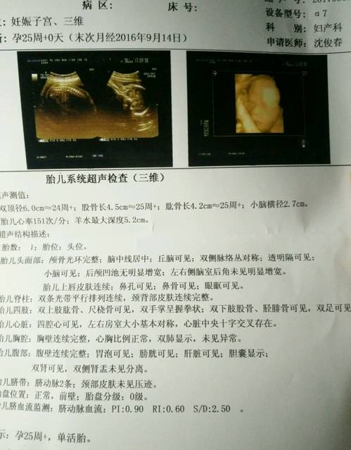 三维_各位准妈妈们如何看胎心率测男女,我宝宝