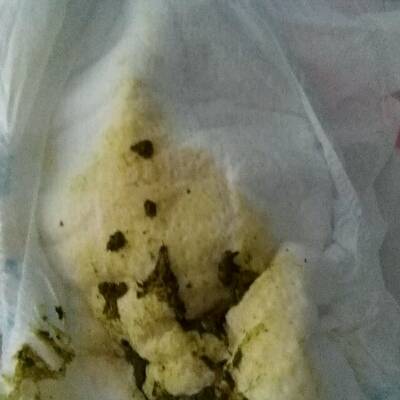 我宝宝拉便便绿色颗粒水壮的是怎么回事?