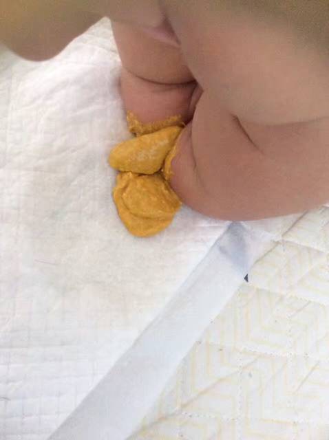 宝宝拉臭臭哭喊阿,是干燥吗?