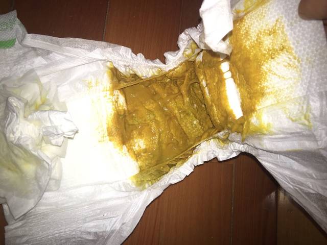 添加辅食后,宝宝便便有点绿,还有颗粒物?有图
