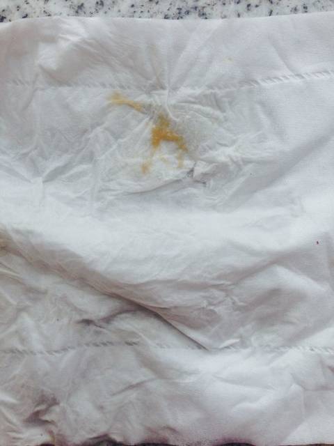 明天8周今早流褐色分泌物了咋办