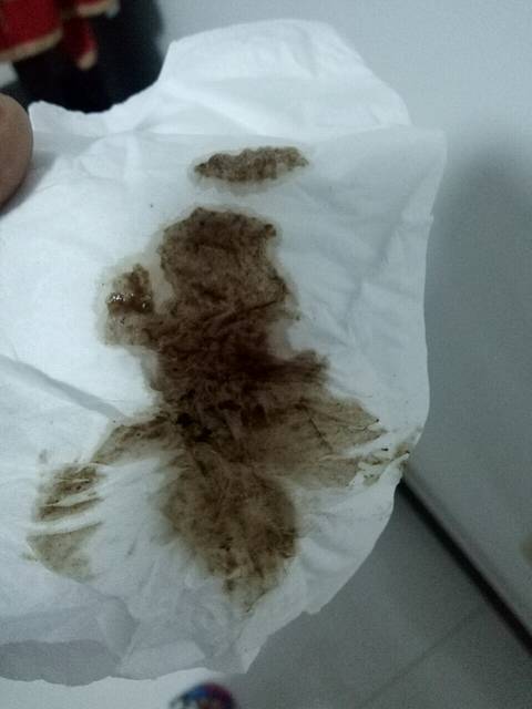 二胎想要女宝_怀孕40天昨天开始有这颜色的分