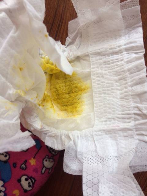 有没有人帮忙看看我宝宝大便正常么_这几天都