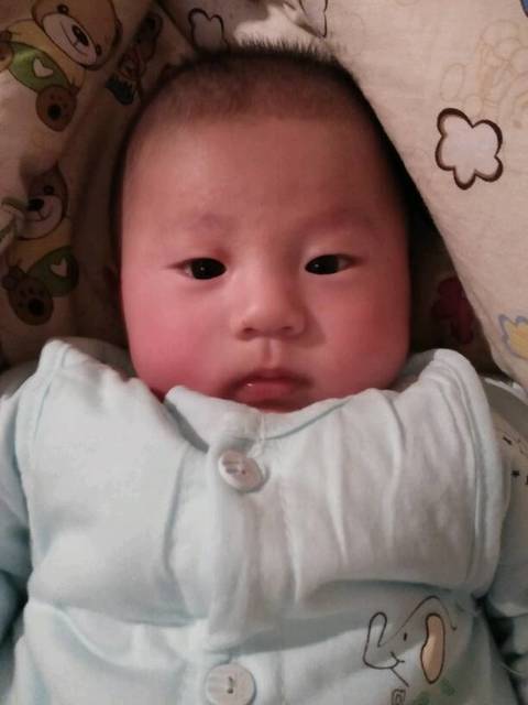 宝宝脸上老爱起红痘痘_宝宝现在三个多月了,最