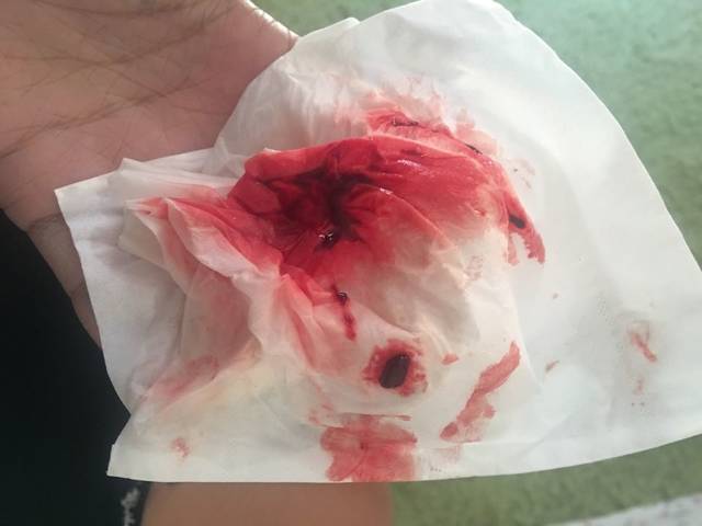 有没有和我一样生化的!_末次月经3.5 4月11 发