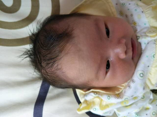 急,宝宝额头处头发颜色不一样,长出来的是金黄