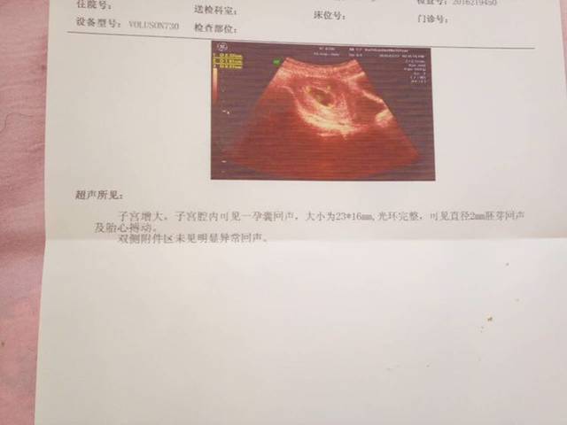 激动得哭了,二胎查了儿子一枚_怀孕7周多了,孕