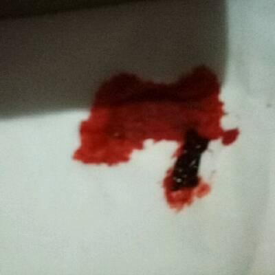 这是怎么回事?为什么会有这么大一坨这个东西