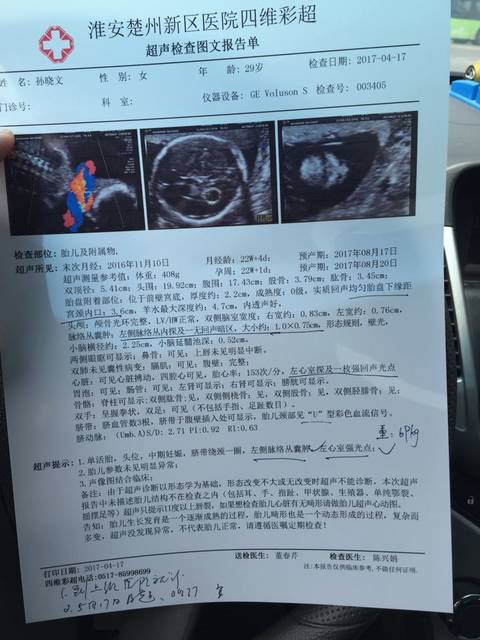 22周查四维彩超_22周查出来左侧脉络丛囊肿,