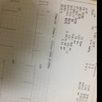 这个心电图正常吗