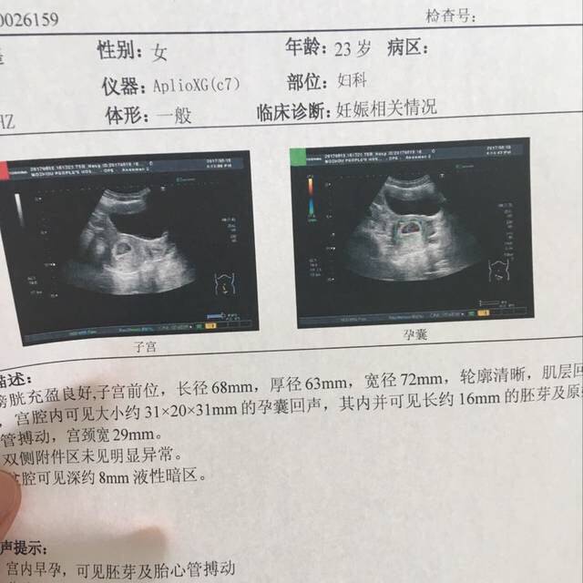 谁帮我看下b超单女生男孩,谢谢了_谁帮我三中德化女孩图片