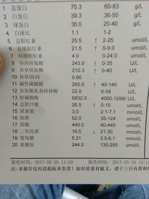 总胆汁酸偏高