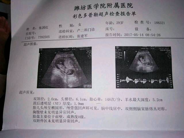 nt图看男女比较靠谱 我的已经验证 大家可以参考一下