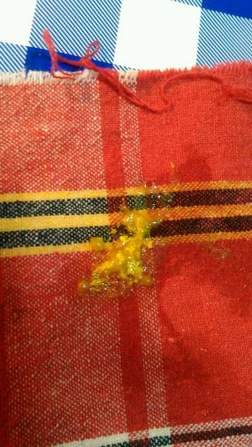 宝宝满月一直拉稀带奶瓣(有图慎入)