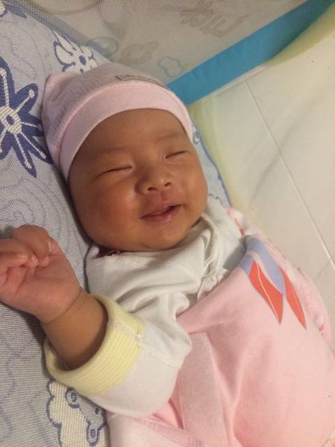 宝宝出生时顺产挤压头上有个小软包_在产科医