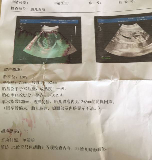 胎儿胃泡里走东西怎么回事?