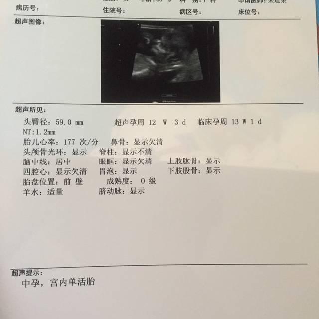12周的 nt单子甩过来,帮你们看男女
