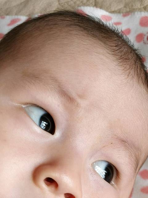 3个月宝宝眼睛有点红血丝需要看医生吗
