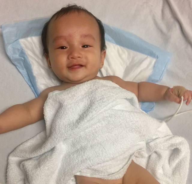 宝宝反复尿路感染