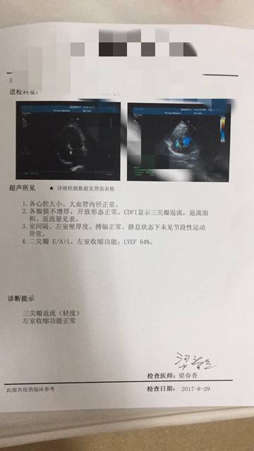 怀孕33周检查左心房增大,难过死了有一样的宝