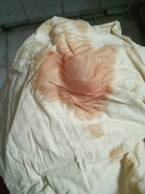 求指点_孕38周,刚起床上厕所的时候发现下面像