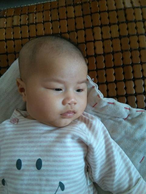 宝宝头盖骨突出