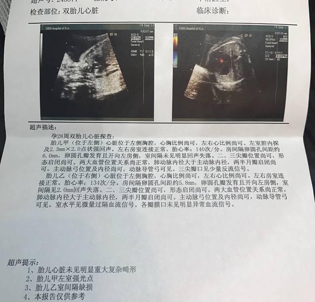 怀孕28周,胎儿查出心脏间隔缺损,有类似经历的