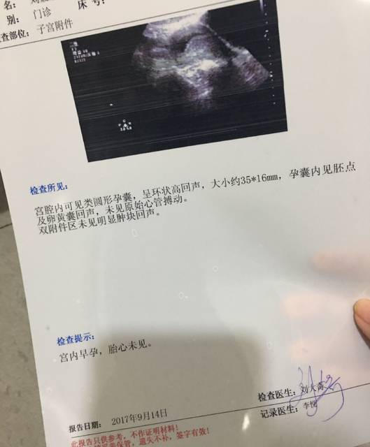 怀孕七周B超单,昨天刚查的。正常吗?好担心