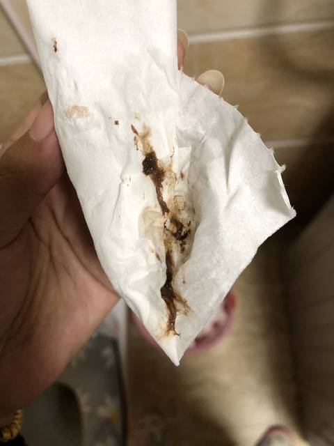 孕晚期出现褐色分泌物
