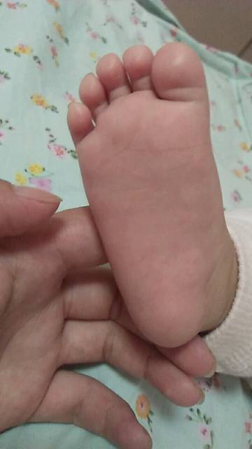 今天发现脚底板起了好多小红点是怎么回事_这