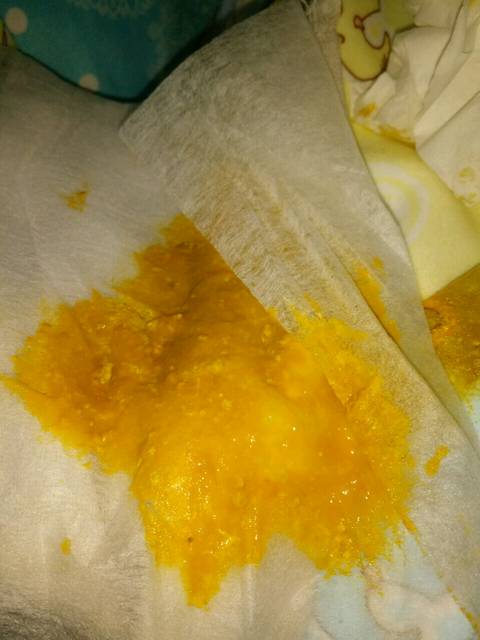 没满月的宝宝大便一直是稀的正常吗?附图_没