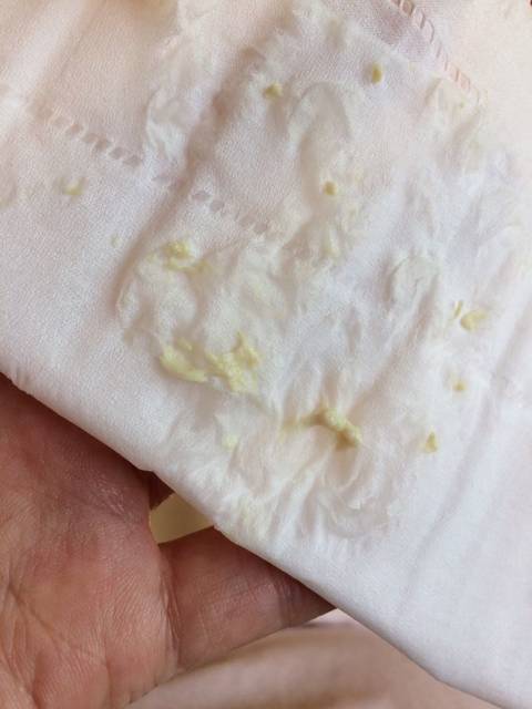 这个能顺产吗?_都快到预产期了,现在下面好痒