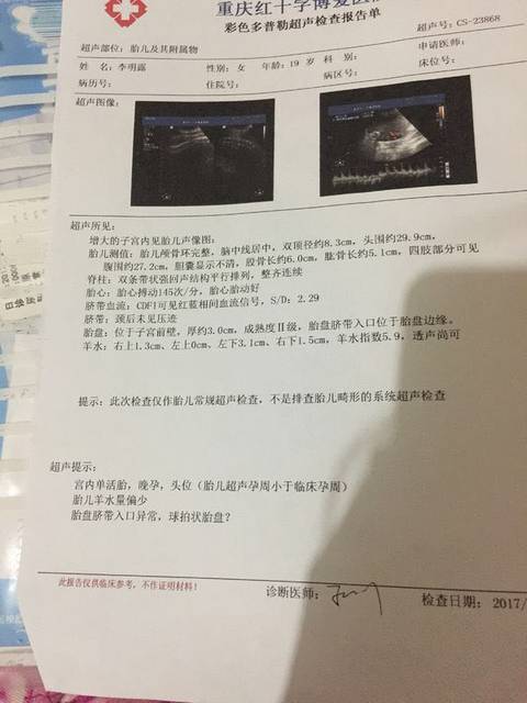 38周羊水指数5.9胎儿偏小三周_38周羊水指数