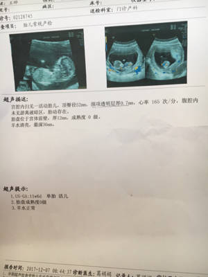 因为之前怀孕 小孩有先天性心脏病 就打掉了现