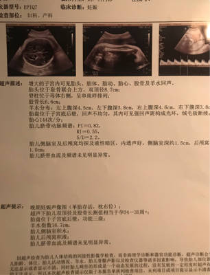 孕33周b超发现胎儿脑积水,1.5cm,前期的无创d