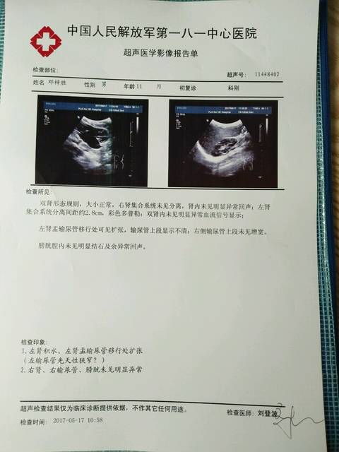 !宝宝先天性肾盂输尿管狭窄,需要动手术
