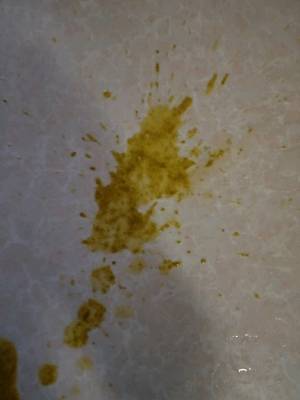 宝宝吃什么药能好使呀到底,我也没去化验屎,愁