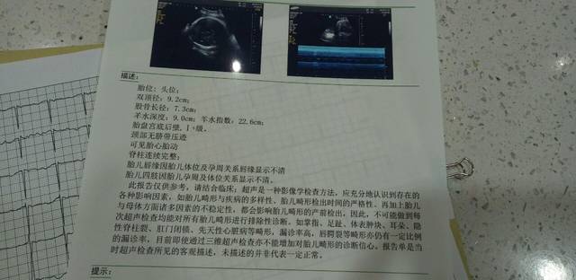 明天38周,类似来月经的隐痛,今天去医院检查了
